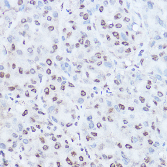 TAF15 Antibody in Immunohistochemistry (Paraffin) (IHC (P))