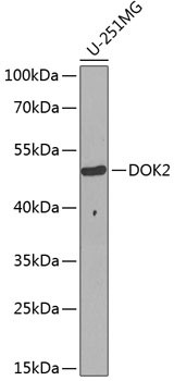 DOK2 Antibody in Western Blot (WB)
