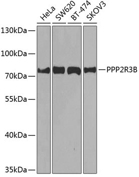 PPP2R3B Antibody in Western Blot (WB)