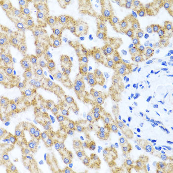 RIPK4 Antibody in Immunohistochemistry (Paraffin) (IHC (P))