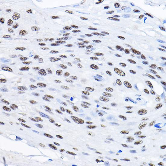SMEK1 Antibody in Immunohistochemistry (Paraffin) (IHC (P))
