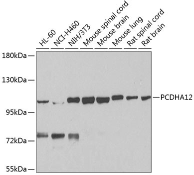 PCDHA12 Antibody in Western Blot (WB)