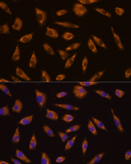 GLP1R Antibody in Immunocytochemistry (ICC/IF)