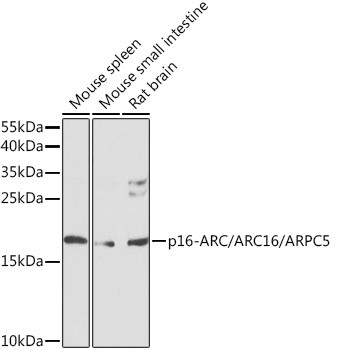ARPC5 Antibody in Western Blot (WB)