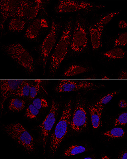 CHCHD3 Antibody in Immunocytochemistry (ICC/IF)