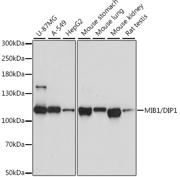 MIB1 Antibody in Western Blot (WB)