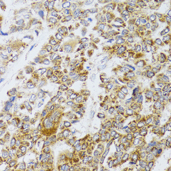 AIFM3 Antibody in Immunohistochemistry (Paraffin) (IHC (P))