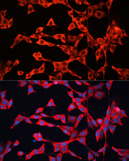 GDI2 Antibody in Immunocytochemistry (ICC/IF)