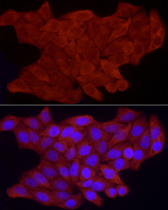 FHL3 Antibody in Immunocytochemistry (ICC/IF)