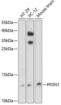 PFDN1 Antibody in Western Blot (WB)