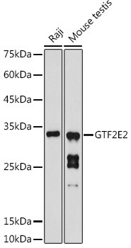 GTF2E2 Antibody in Western Blot (WB)