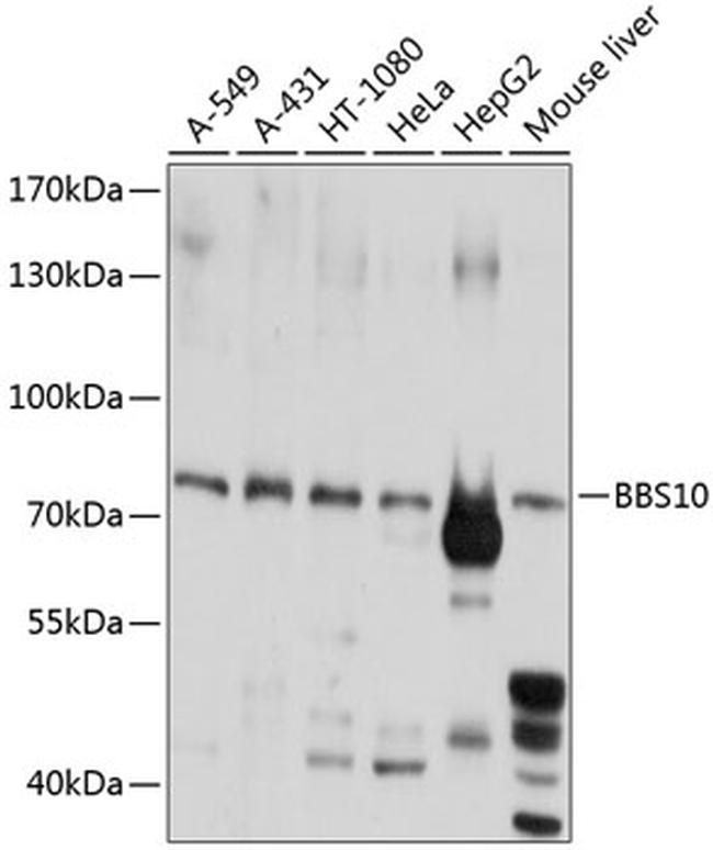 BBS10 Antibody in Western Blot (WB)