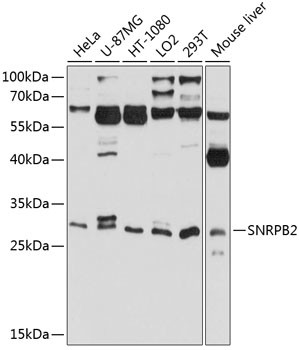 SNRPB2 Antibody in Western Blot (WB)