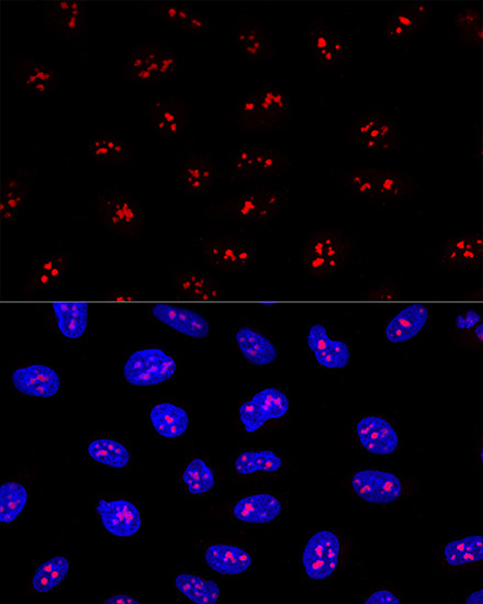 EBNA1BP2 Antibody in Immunocytochemistry (ICC/IF)