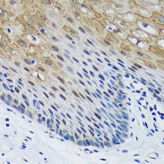 PSPC1 Antibody in Immunohistochemistry (Paraffin) (IHC (P))