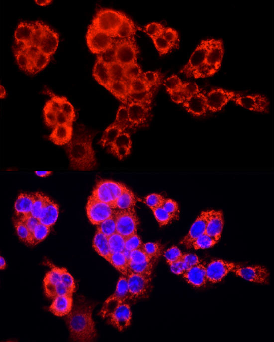 SEC31A Antibody in Immunocytochemistry (ICC/IF)