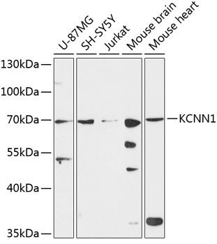 KCNN1 Antibody in Western Blot (WB)