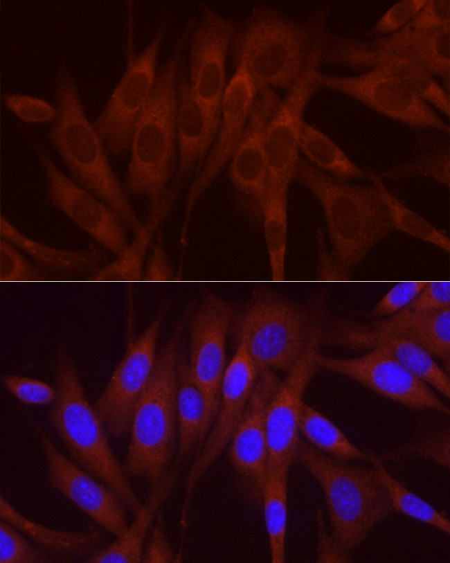 NUMB Antibody in Immunocytochemistry (ICC/IF)
