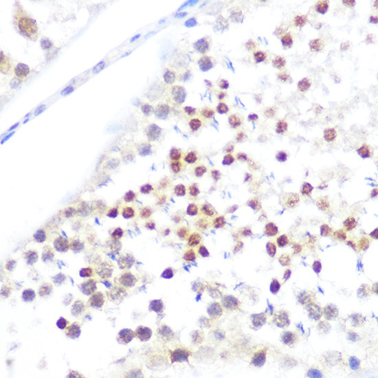 NUP50 Antibody in Immunohistochemistry (Paraffin) (IHC (P))
