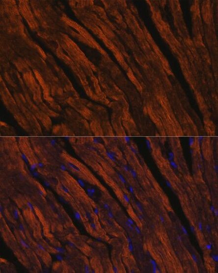 MYH6 Antibody in Immunohistochemistry (IHC)