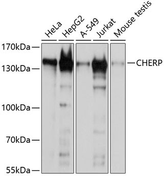 CHERP Antibody in Western Blot (WB)