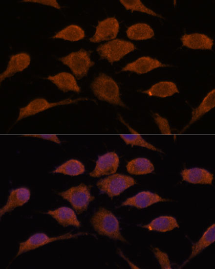 USP19 Antibody in Immunocytochemistry (ICC/IF)