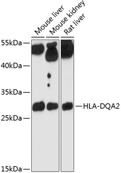 HLA-DQA2 Antibody in Western Blot (WB)