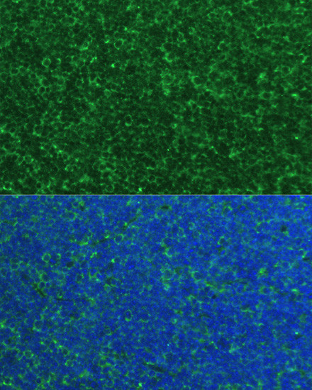 NOXA Antibody in Immunocytochemistry (ICC/IF)