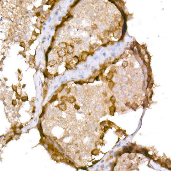 CTAG1B Antibody in Immunohistochemistry (Paraffin) (IHC (P))