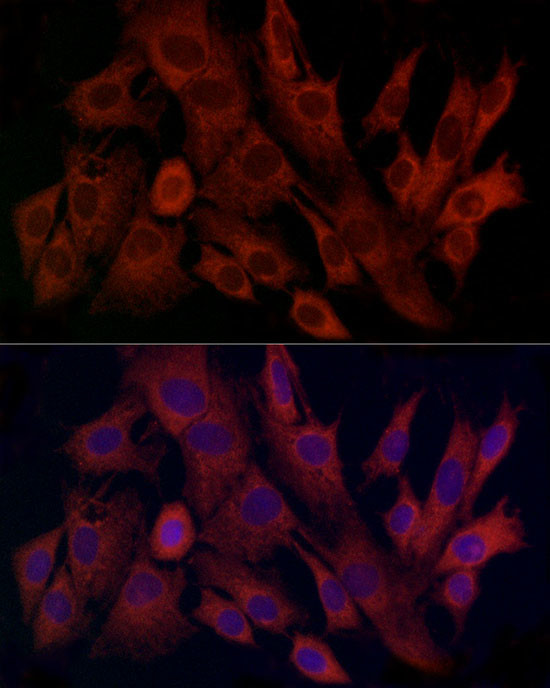 TIMM8A Antibody in Immunocytochemistry (ICC/IF)