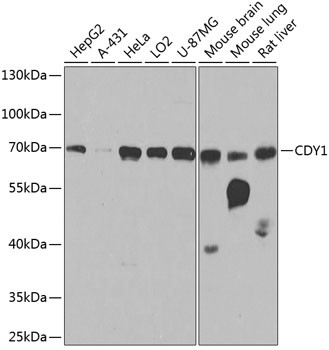 CDY1 Antibody in Western Blot (WB)