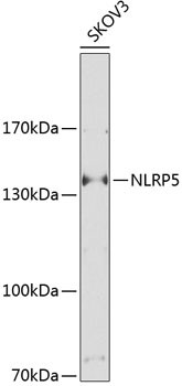 NALP5 Antibody in Western Blot (WB)