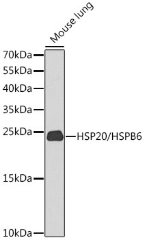 HSP20 Antibody in Western Blot (WB)