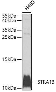 STRA13 Antibody in Western Blot (WB)