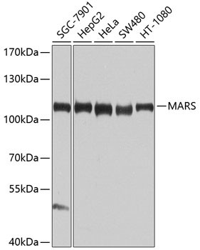 MARS Antibody in Western Blot (WB)