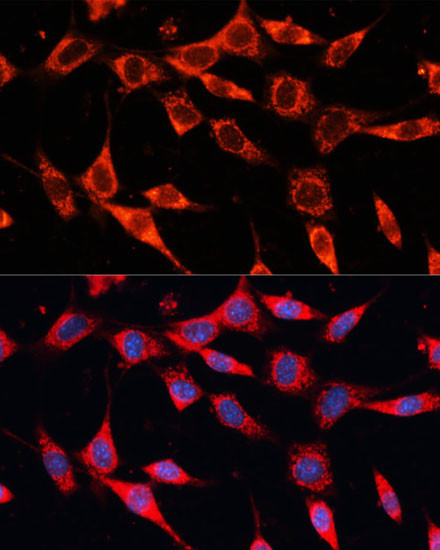 PDHA2 Antibody in Immunocytochemistry (ICC/IF)