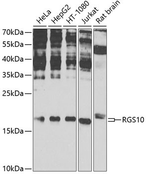 RGS10 Antibody in Western Blot (WB)