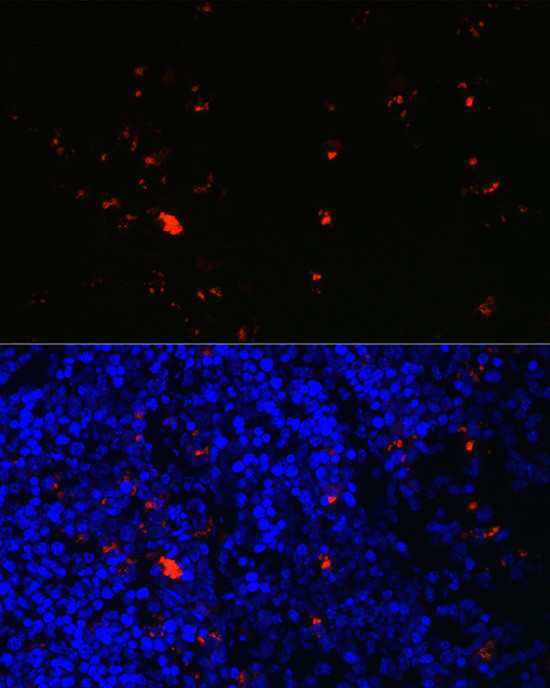 RNASE2 Antibody in Immunohistochemistry (Paraffin) (IHC (P))