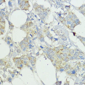 SOCS6 Antibody in Immunohistochemistry (Paraffin) (IHC (P))