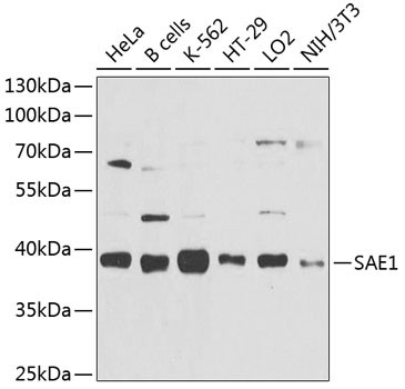 SAE1 Antibody in Western Blot (WB)