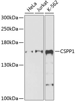 CSPP1 Antibody in Western Blot (WB)