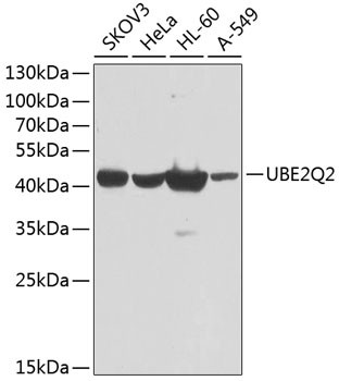 UBE2Q2 Antibody in Western Blot (WB)