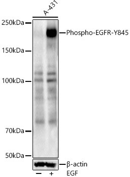 Phospho-EGFR (Tyr845) Antibody in Western Blot (WB)