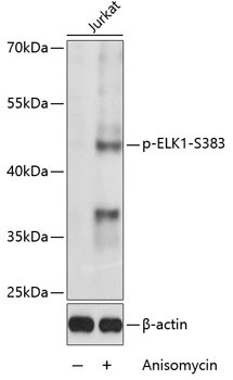 Phospho-ELK1 (Ser383) Antibody in Western Blot (WB)