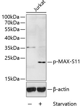 Phospho-MAX (Ser11) Antibody in Western Blot (WB)