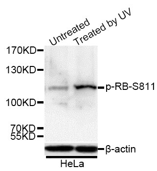 Phospho-Rb (Ser811) Antibody in Western Blot (WB)