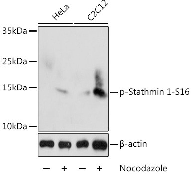 Phospho-Stathmin 1 (Ser16) Antibody in Western Blot (WB)