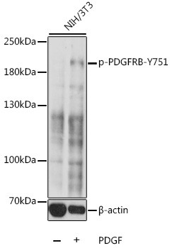 Phospho-PDGFRB (Tyr751) Antibody in Western Blot (WB)