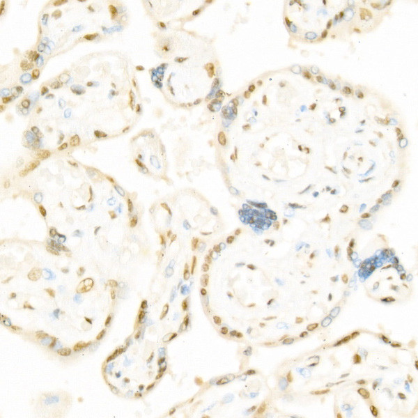 Phospho-c-Raf (Ser338) Antibody in Immunohistochemistry (Paraffin) (IHC (P))