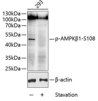 Phospho-AMPK beta-1 (Ser108) Antibody in Western Blot (WB)